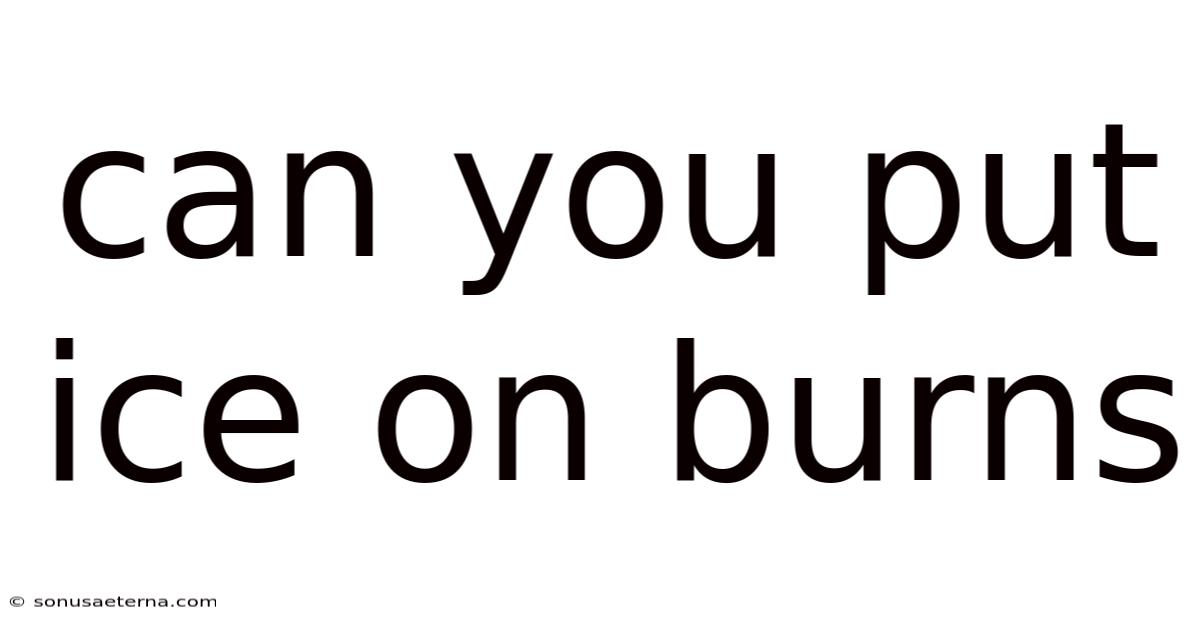 Can You Put Ice On Burns