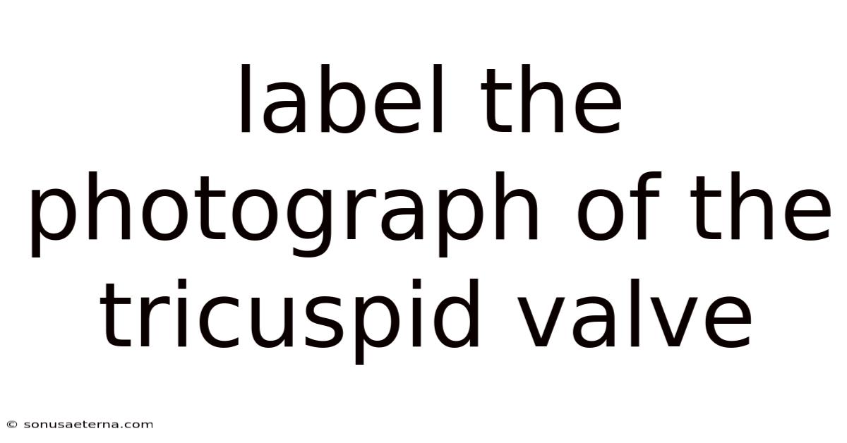 Label The Photograph Of The Tricuspid Valve