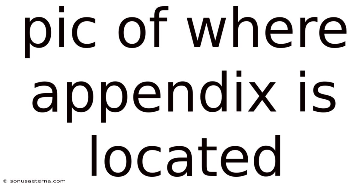 Pic Of Where Appendix Is Located