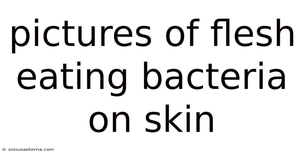 Pictures Of Flesh Eating Bacteria On Skin